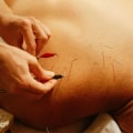 Electroacupuncture for Mental Health in Portland