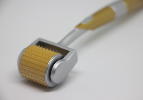 Boost Your Confidence with Microneedling and Mental Health Services in Zurich
