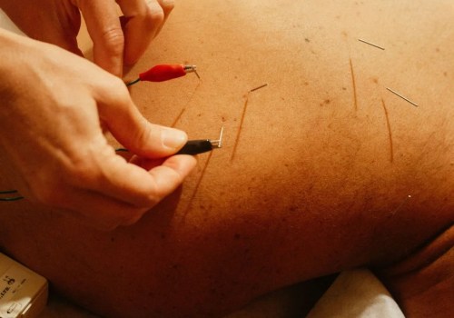 Electroacupuncture for Mental Health in Portland